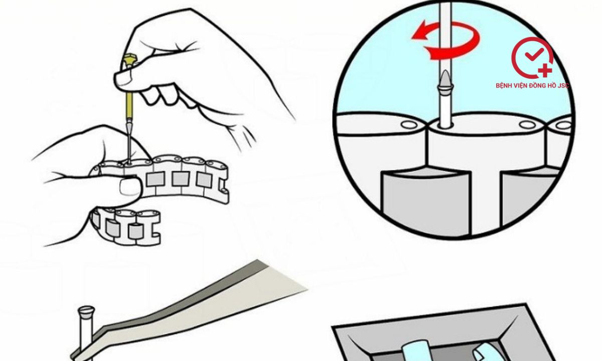 cach-thao-mat-dong-ho cách tháo mắt đồng hồ