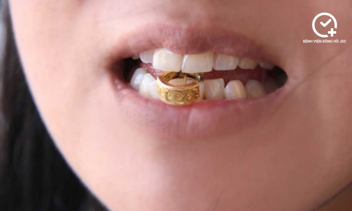 cach nhan biet vang that cách nhận biết vàng thật